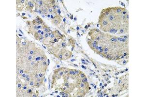Immunohistochemistry of paraffin-embedded Human stomach using NDUFA6 Polyclonal Antibody at dilution of 1:100 (40x lens). (NDUFA6 抗体)