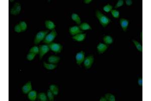 Immunofluorescence staining of Hela cells with ABIN7175567 at 1:50, counter-stained with DAPI. (VDAC3 抗体  (AA 40-160))
