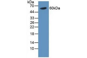 Detection of TRAF4 in Human Blood Cells using Polyclonal Antibody to TNF Receptor Associated Factor 4 (TRAF4) (TRAF4 抗体  (AA 193-444))