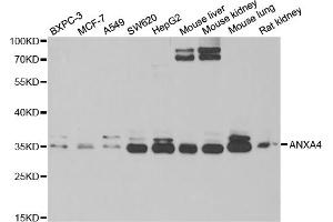 Western blot analysis of extracts of various cell lines, using ANXA4 antibody (ABIN5973706) at 1/1000 dilution. (Annexin IV 抗体)