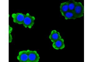 Immunofluorescence analysis of CRC cells using PRKCA antibody (ABIN4904772). (PKC alpha 抗体)