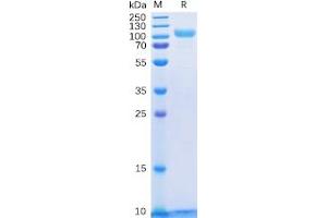 Human HER3 Protein, His Tag on SDS-PAGE under reducing condition. (ERBB3 Protein (His tag))