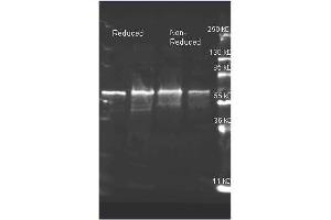 Goat anti Choline Oxidase antibody was used to detect Choline Oxidase. (Choline Oxidase 抗体  (Biotin))