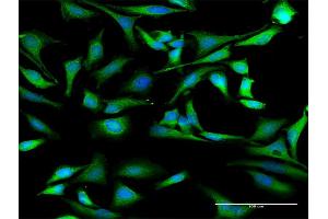 Immunofluorescence of purified MaxPab antibody to HNRNPD on HeLa cell. (HNRNPD/AUF1 抗体  (AA 1-355))