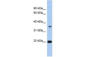 FAIM antibody used at 1 ug/ml to detect target protein. (FAIM 抗体  (N-Term))