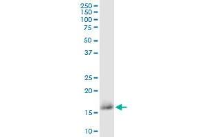 CD59 monoclonal antibody (M02), clone 3G6. (CD59 抗体  (AA 1-128))