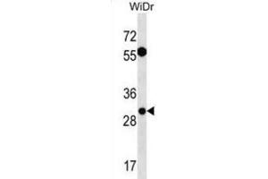 Western Blotting (WB) image for anti-Exosome Component 6 (EXOSC6) antibody (ABIN3000677) (EXOSC6 抗体)