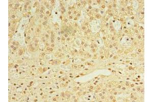 Immunohistochemistry of paraffin-embedded human adrenal gland tissue using ABIN7168458 at dilution of 1:100 (UTP23 抗体  (AA 1-249))