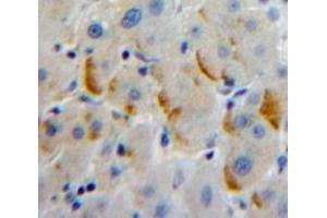 Used in DAB staining on fromalin fixed paraffin-embedded Liver tissue