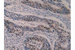 Immunohistochemistry (IHC) image for anti-Arachidonate 5-Lipoxygenase (ALOX5) (AA 461-671) antibody (ABIN7433525)