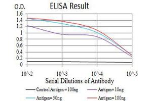 Black line: Control Antigen (100 ng),Purple line: Antigen (10 ng), Blue line: Antigen (50 ng), Red line:Antigen (100 ng) (UCP2 抗体  (AA 1-309))