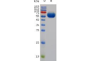 Mouse CD200 Protein, hFc Tag on SDS-PAGE under reducing condition.