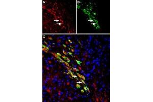 Immunohistochemistry (IHC) image for anti-Solute Carrier Family 18 (Vesicular Monoamine Transporter), Member 2 (SLC18A2) (AA 52-64) antibody (ABIN7043688)