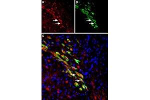 Expression of VMAT2 in rat substantia nigra dopaminergic neurons - Immunohistochemical staining of perfusion-fixed frozen rat brain sections using Anti-VMAT2 Antibody (ABIN7043688, ABIN7044610 and ABIN7044611), (1:1000). (SLC18A2 抗体  (1st Lumenal Region))