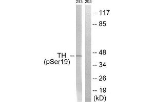 Western Blotting (WB) image for anti-Tyrosine Hydroxylase (TH) (pSer19) antibody (ABIN1847228) (Tyrosine Hydroxylase 抗体  (pSer19))