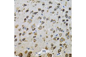 Immunohistochemistry of paraffin-embedded rat brain using NCF4 Antibody (ABIN1873838) at dilution of 1:100 (40x lens). (NCF4 抗体)