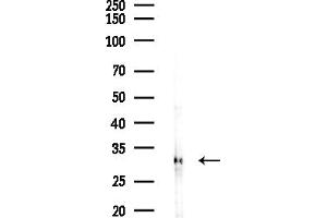 Western blot analysis of lysates from COLO205 cells(UV,30 min treatment), using VDAC2 Antibody at 1/1000 dilution.