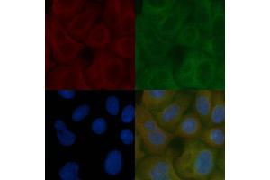 TMEM123 Mouse Monoclonal Antibody staining Hela cells by IF/ICC. (TMEM123 抗体)