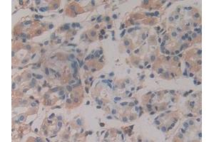 Immunohistochemistry (IHC) image for anti-Haptoglobin (HP) (AA 44-157) antibody (ABIN7429061)
