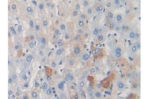 Detection of TARC in Mouse Liver Tissue using Polyclonal Antibody to Thymus Activation Regulated Chemokine (TARC) (CCL17 抗体  (AA 12-83))