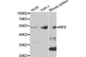 Western blot analysis of extracts of various cell lines, using IRF8 antibody. (IRF8 抗体)