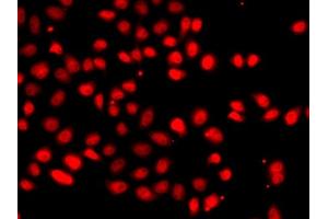 Immunofluorescence analysis of  cells using EP/HIF2α antibody (ABIN6127869, ABIN6141764, ABIN6141765 and ABIN6223457). (EPAS1 抗体  (AA 588-870))