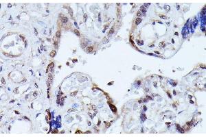 Immunohistochemistry (Paraffin-embedded Sections) (IHC (p)) image for anti-Vir Like m6A Methyltransferase Associated (VIRMA) antibody (ABIN7258994)