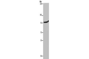 Western Blotting (WB) image for anti-Mitogen-Activated Protein Kinase Kinase Kinase 11 (MAP3K11) antibody (ABIN2433391) (MAP3K11 抗体)