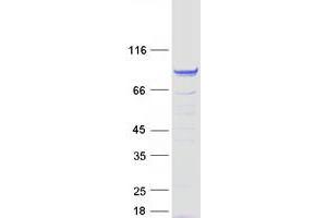 Validation with Western Blot (FSIP1 Protein (Myc-DYKDDDDK Tag))