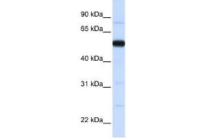 THUMPD2 antibody used at 1 ug/ml to detect target protein. (THUMPD2 抗体  (N-Term))
