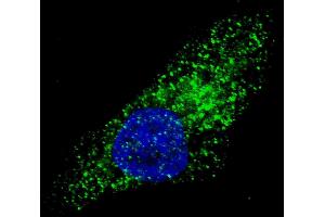 Fluorescent image of  cells stained with ATG9A (C-term) antibody. (ATG9A 抗体  (C-Term))