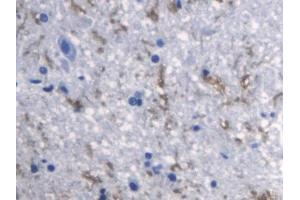 DAB staining on IHC-P; Samples: Rat Spinal cord Tissue (RANKL 抗体  (AA 106-240))