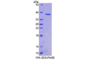 SDS-PAGE analysis of Human BMP3 Protein. (BMP3 蛋白)