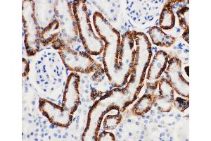 Immunohistochemistry (IHC) image for anti-Solute Carrier Family 22 Member 6 (SLC22A6) (AA 534-550), (C-Term) antibody (ABIN3044261)