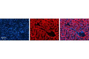 P4HB antibody - C-terminal region          Formalin Fixed Paraffin Embedded Tissue:  Human Liver Tissue    Observed Staining:  Cytoplasm in hepatocytes   Primary Antibody Concentration:  1:100    Secondary Antibody:  Donkey anti-Rabbit-Cy3    Secondary Antibody Concentration:  1:200    Magnification:  20X    Exposure Time:  0. (P4HB 抗体  (C-Term))