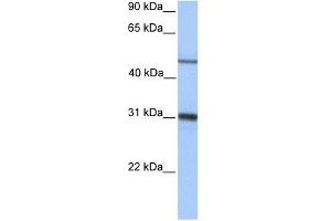 EPHX1 antibody used at 1 ug/ml to detect target protein. (EPHX1 抗体)
