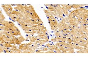 Immunohistochemistry (IHC) image for anti-Matrix Metallopeptidase 9 (Gelatinase B, 92kDa Gelatinase, 92kDa Type IV Collagenase) (MMP9) (AA 225-390) antibody (APC) (ABIN7443959)