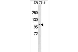 PDCD6IP Antibody (Center) (ABIN1881644 and ABIN2838904) western blot analysis in ZR-75-1 cell line lysates (35 μg/lane).