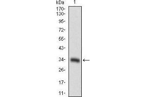 Western blot analysis using CD93 mAb against human CD93 recombinant protein. (CD93 抗体  (AA 474-535))