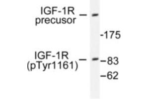 Image no. 1 for anti-Insulin-Like Growth Factor 1 Receptor (IGF1R) (pTyr1161) antibody (ABIN318045) (IGF1R 抗体  (pTyr1161))