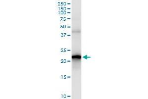 Immunoprecipitation of SELS transfected lysate using anti-SELS MaxPab rabbit polyclonal antibody and Protein A Magnetic Bead , and immunoblotted with SELS purified MaxPab mouse polyclonal antibody (B02P) . (Selenoprotein S 抗体  (AA 1-187))