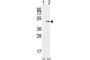 Western Blotting (WB) image for anti-SET Domain Containing 8 Pseudogene 1 (SETD8P1) antibody (ABIN2996451) (SET7 抗体)