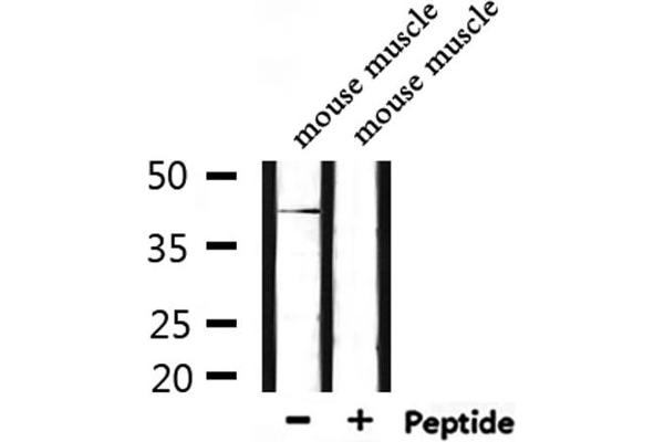 HORMAD1 抗体  (C-Term)