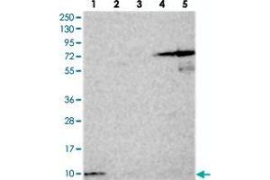 Western blot analysis of Lane 1: RT-4, Lane 2: U-251 MG, Lane 3: Human Plasma, Lane 4: Liver, Lane 5: Tonsil with HIGD1A polyclonal antibody  at 1:250-1:500 dilution. (HIGD1A 抗体)