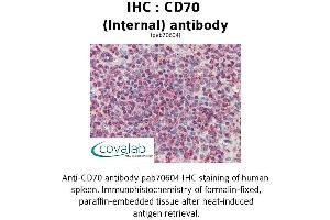 Image no. 1 for anti-CD70 Molecule (CD70) (Internal Region) antibody (ABIN1732875) (CD70 抗体  (Internal Region))