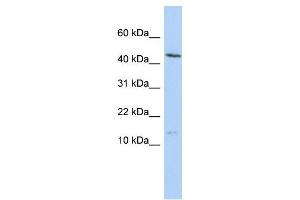 MYL6 antibody used at 1 ug/ml to detect target protein. (MYL6 抗体  (N-Term))
