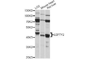 Western blot analysis of extracts of various cell lines, using LEFTY2 antibody (ABIN6292173) at 1:1000 dilution. (LEFTY2 抗体)