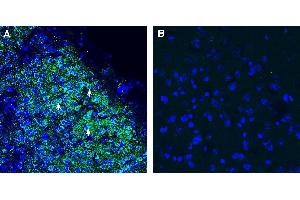 Expression of SORCS1 in mouse parietal cortex.