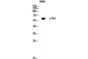 Western Blot (WB) analysis of HeLa using c-Src Polyclonal Antibody. (Src 抗体  (Tyr1172))