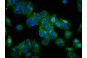 Immunofluorescence staining of HepG2 cells with ABIN7159174 at 1:66, counter-stained with DAPI. (OPN1MW 抗体  (AA 1-52))